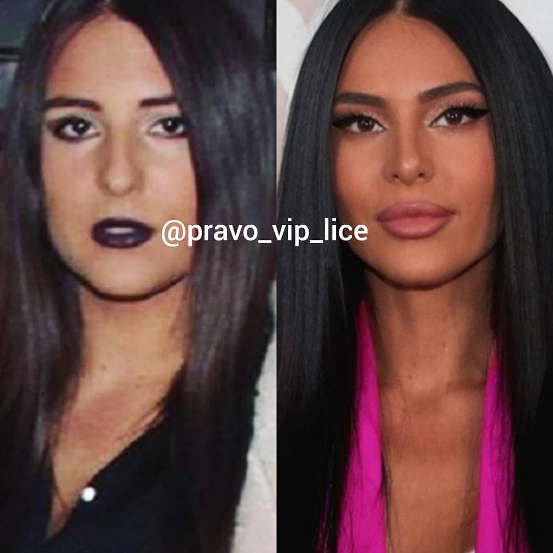 Da li su OVO ISTE OSOBE? Najveće transformacije poznatih (FOTO + VIDEO) 3 0d09088694941f21a9f09e28198d7dfce2d6221b