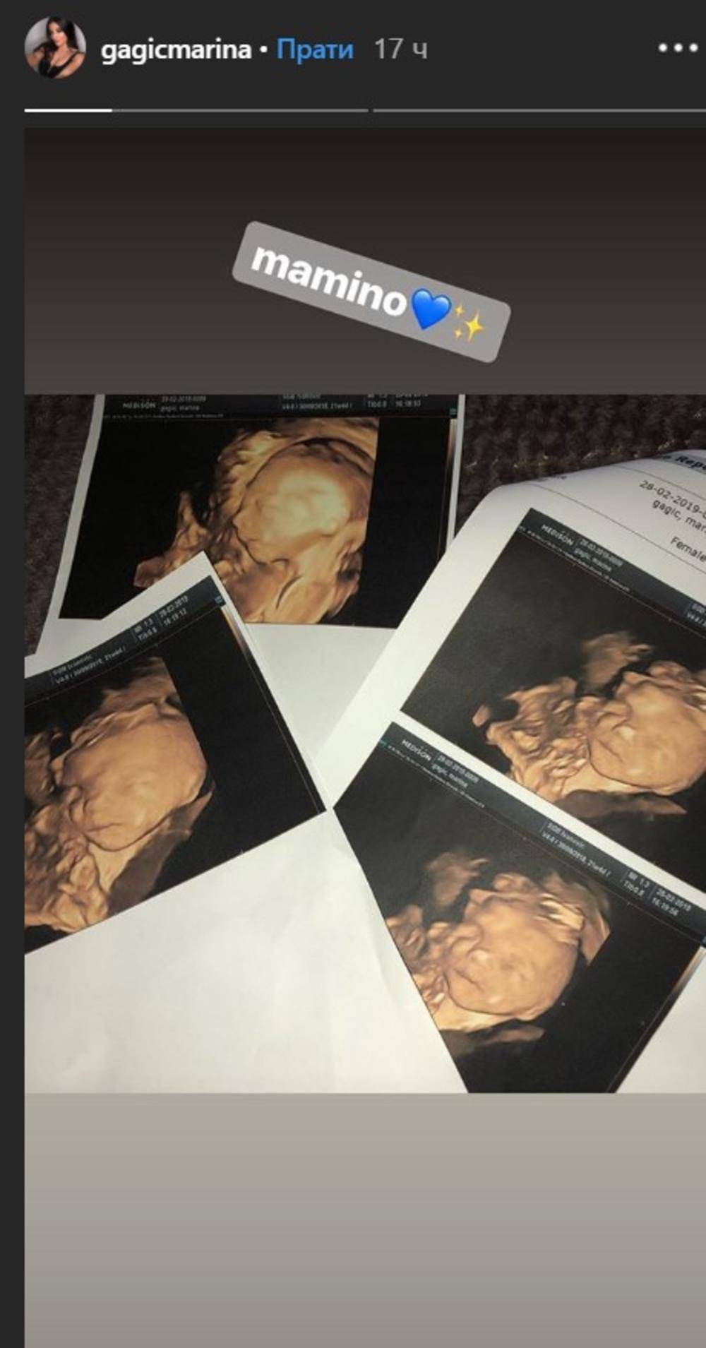 STIŽE NASLEDNIK: Verenica Darka Lazića objavila fotografije sa ultrazvuka (FOTO) 2 7a5c231d0d0727f7d72324ae96fa6e0301afcd15