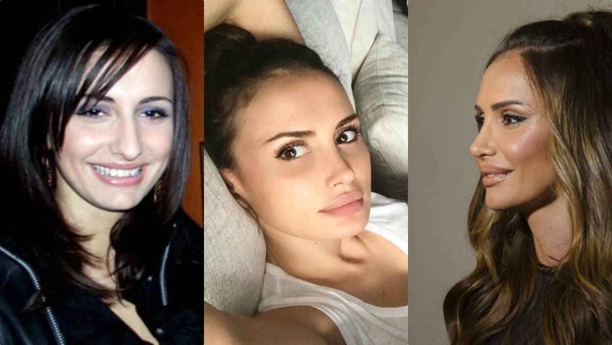 6 najuspešnijih operacija nosa poznatih (FOTO) 6 fc5810df3436a607f7b425aef13aa81fd7d662f9