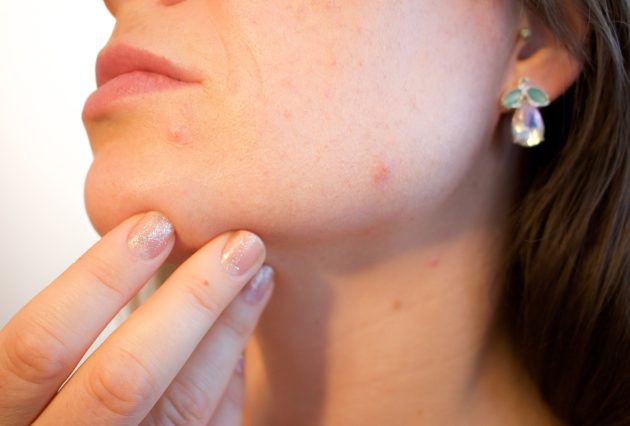 acne ga797737a0 1920