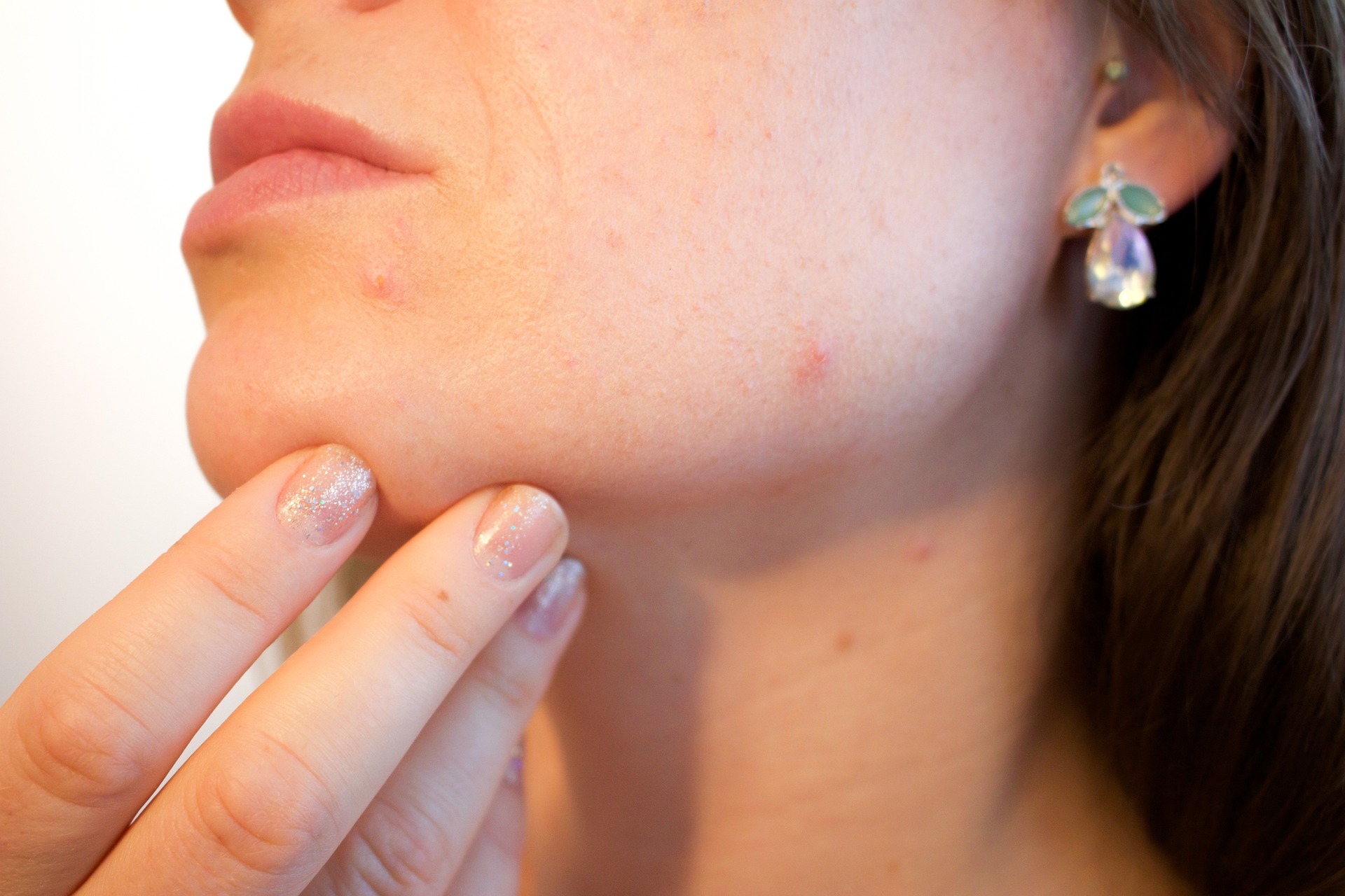 acne ga797737a0 1920