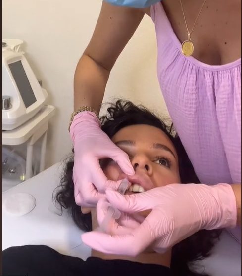Martina Jozinović ponovo dopumpala usta? Pevačica pokazala detalje procedure koja nije za one sa slabim srcem: "Ovo mnogo više boli" (VIDEO) 7 mmm