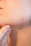 acne 1606765 1280