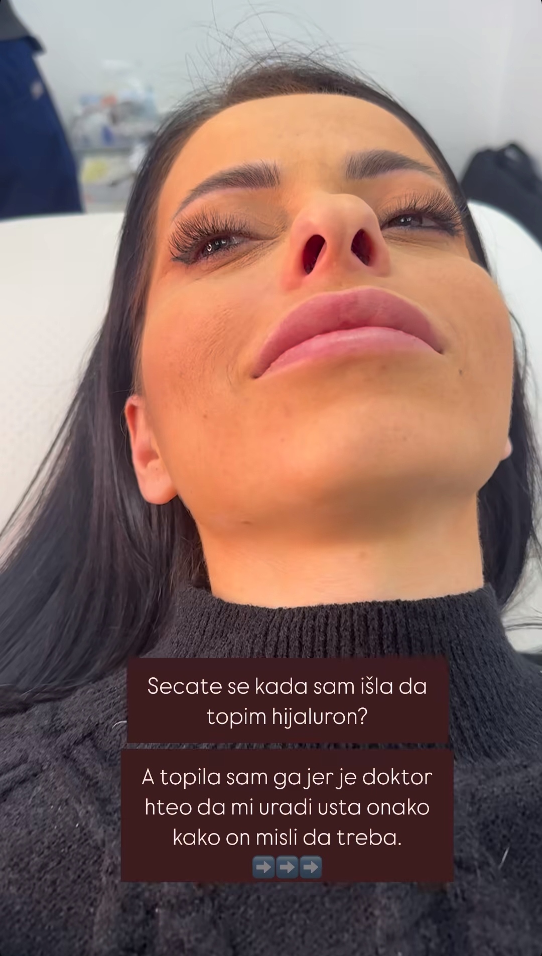 Žena Darka Lazića ponovo na remontu, svi komentarišu rezultat intervencije FOTO 7 katarina lazic 3