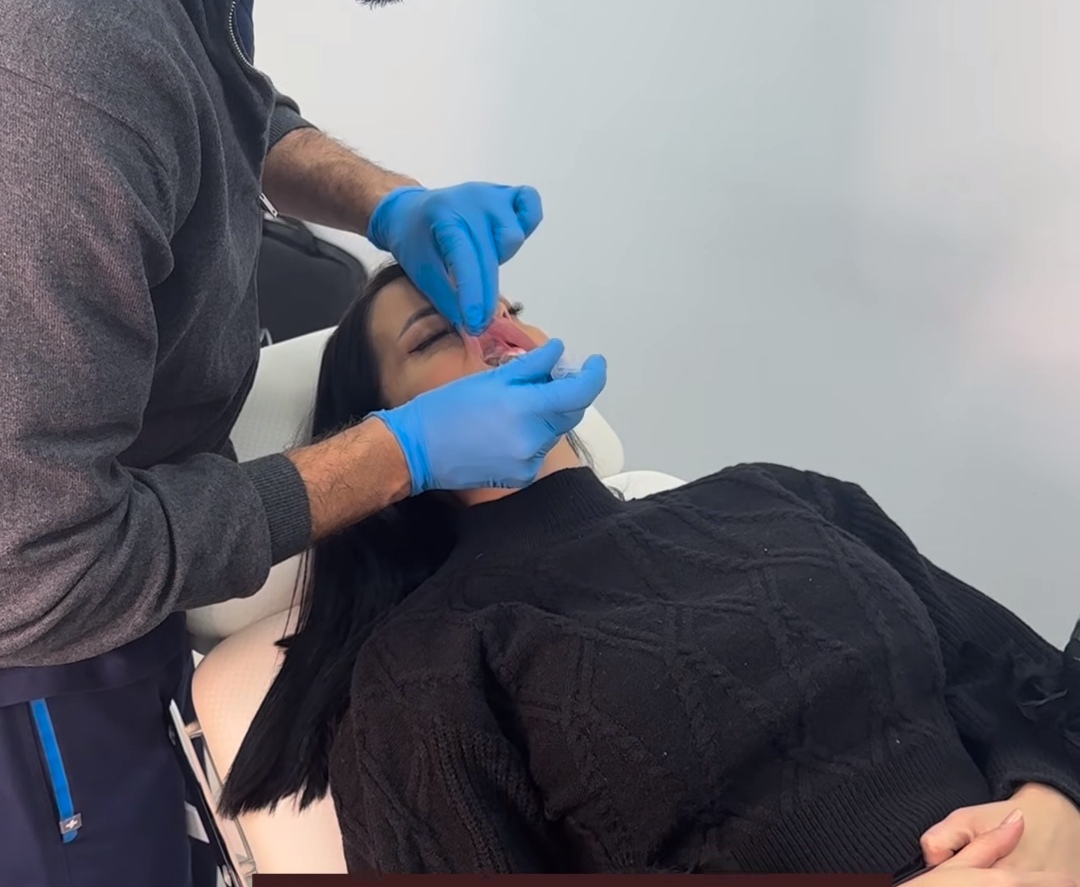 Žena Darka Lazića ponovo na remontu, svi komentarišu rezultat intervencije FOTO 8 katarina lazic 6