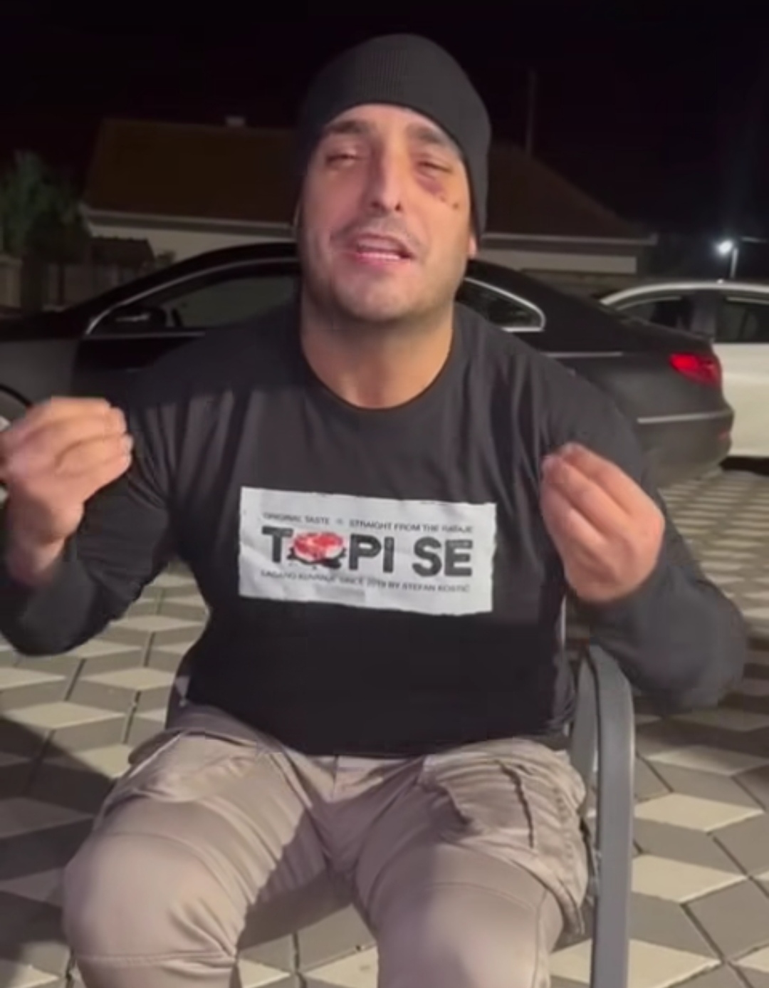 Šavovi i ožiljci po sred lica: Darko Lazić u podlivima kuva mućkalicu nakon saobraćajke VIDEO 5 Darko Lazic 1