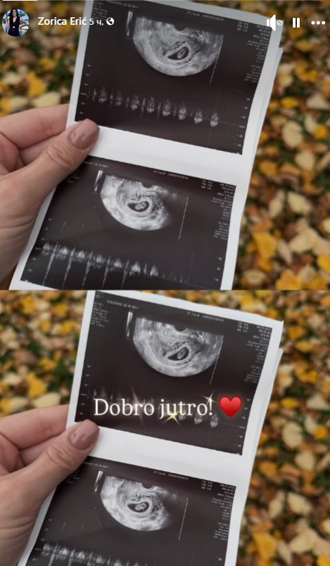zorica eric postaje baba