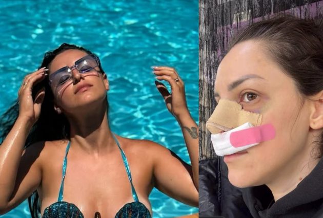 marija gruevska operisala nos