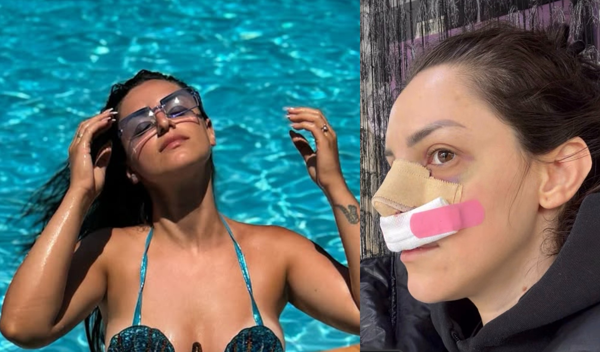marija gruevska operisala nos