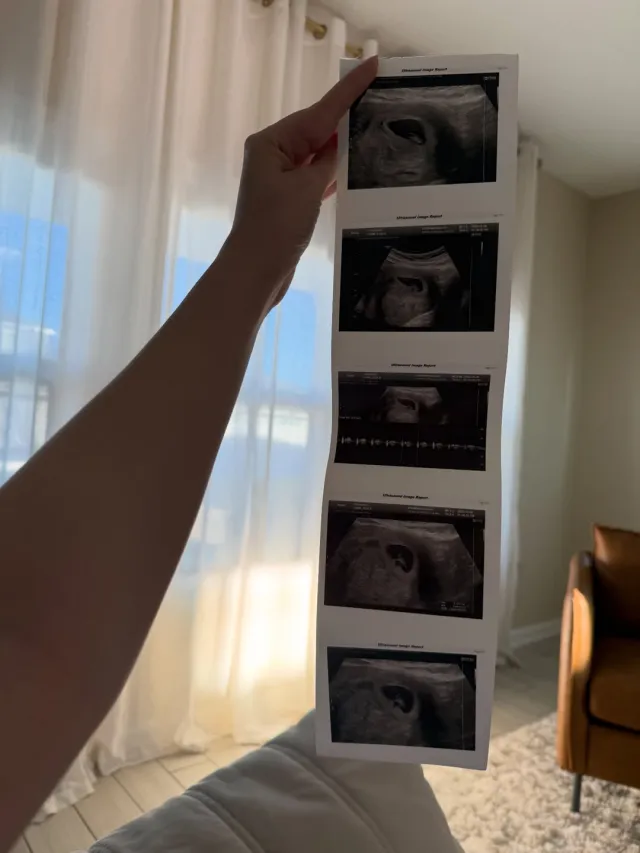 Dolazi ljubav: Đula Drini otkrila pol bebe 6 DJula drini trudna 640x853 1