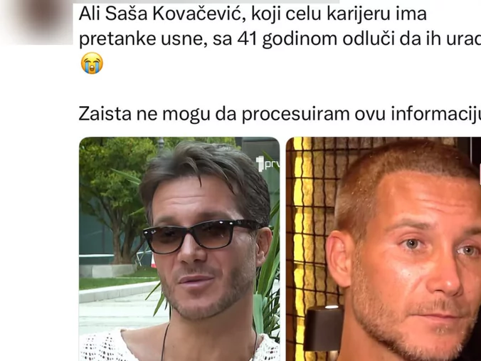 Saša Kovačević promenio izgled: Uvećao usne, a mreže bruje o njegovoj transformaciji, razlika je drastična (FOTO) 6 image 197